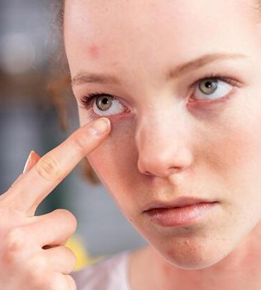 gozyasi-kanali-tikanikligina-izsiz-kanamasiz-cozum-c48c7e82b1485c5d68f9d1ecef2fbf7b