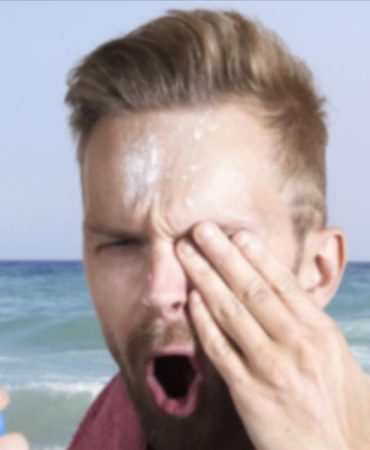 gozde-olusan-gunes-yanigi-gorme-kaybina-yol-aciyor-15773b0acec6e66cf2eed63394eecb2e