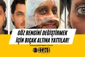 Neden ve niye soruları aklımıza ilk gelenler olsa da bu yöntemi tercih edenler yok değil. Özellikle maviye dönüşen göz renklerinin sonucu kimine göre etkileyici olsa da “Ne kadar sağlıklı?” sorusu kafamıza takılıyor.