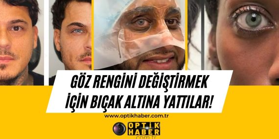 Neden ve niye soruları aklımıza ilk gelenler olsa da bu yöntemi tercih edenler yok değil. Özellikle maviye dönüşen göz renklerinin sonucu kimine göre etkileyici olsa da “Ne kadar sağlıklı?” sorusu kafamıza takılıyor.