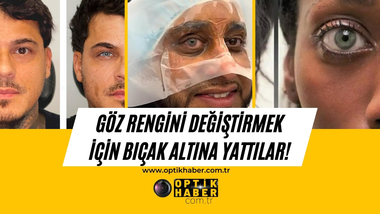 Neden ve niye soruları aklımıza ilk gelenler olsa da bu yöntemi tercih edenler yok değil. Özellikle maviye dönüşen göz renklerinin sonucu kimine göre etkileyici olsa da “Ne kadar sağlıklı?” sorusu kafamıza takılıyor.
