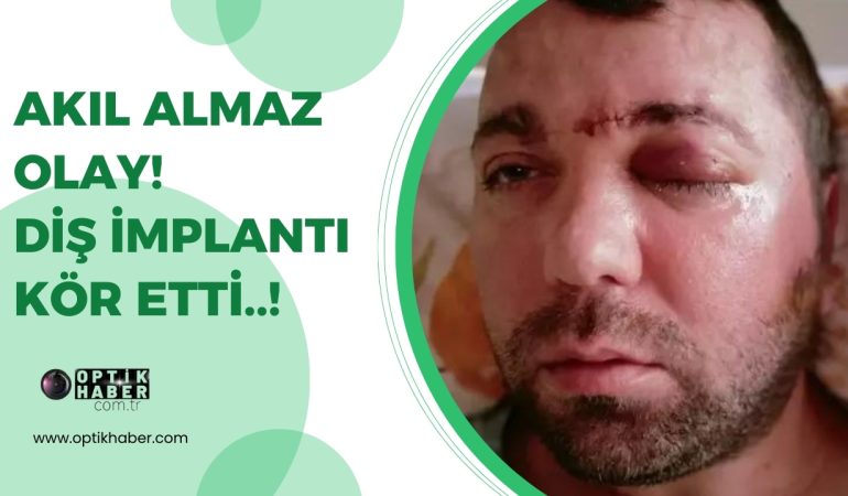 Optikhaber tasarımları (1)