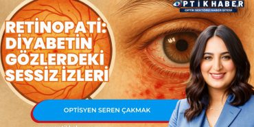 Optikhaber tasarımmları