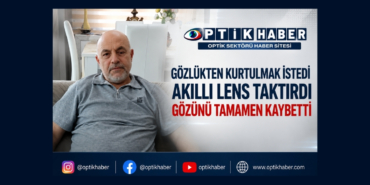 göz